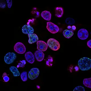 ADU Students Explore New Frontiers in Oncology
